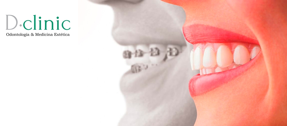 DCLINIC ¡TODO BRAKETS! - DCLINIC DCLINIC ¡TODO BRAKETS! - DCLINIC - Club De Suscriptores El Comercio Perú.